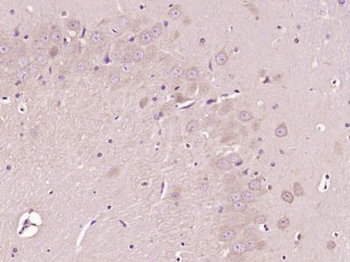 HECT E3 ubiquitin ligase Polyclonal Antibody