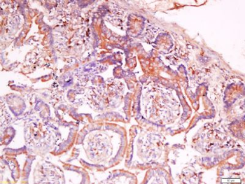 C2orf16 Polyclonal Antibody