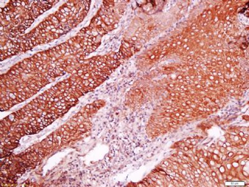 C2orf16 Polyclonal Antibody