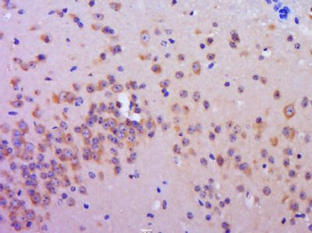 C20orf94 Polyclonal Antibody