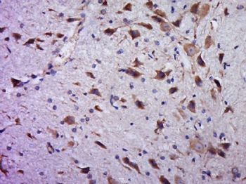 C20orf94 Polyclonal Antibody