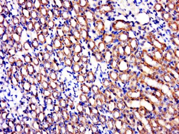 C1orf69 Polyclonal Antibody