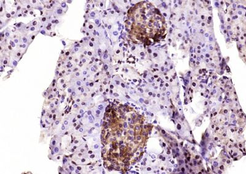 EDARADD Polyclonal Antibody