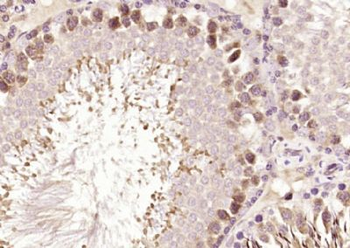Syntaxin 12 Polyclonal Antibody