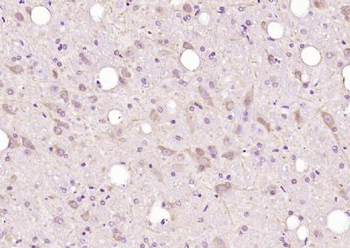 DDX41 Polyclonal Antibody