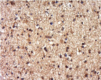 DEPDC1B/BRCC3 Polyclonal Antibody