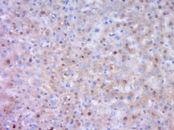 DENND4B Polyclonal Antibody