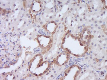 DENND4B Polyclonal Antibody