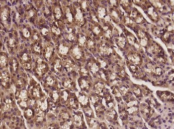 DENND3 Polyclonal Antibody