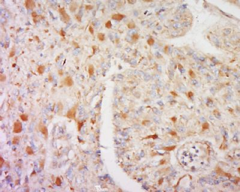 CORO2B Polyclonal Antibody