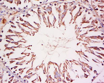 CoREST3 Polyclonal Antibody
