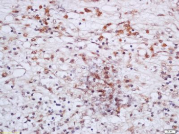 CHD8 Polyclonal Antibody