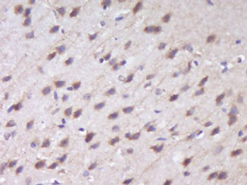 RUSC1 Polyclonal Antibody