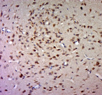 GLT1D1 Polyclonal Antibody