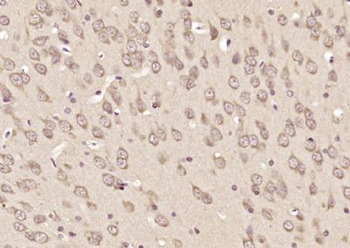 Gemin 6 Polyclonal Antibody