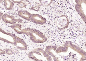 Gemin 4 Polyclonal Antibody