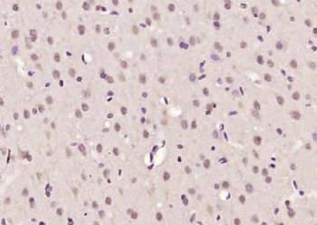 ELK4 Polyclonal Antibody