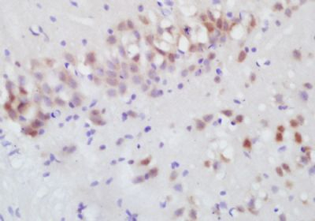 DCPS Polyclonal Antibody