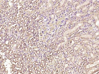 SNRNP200 Polyclonal Antibody