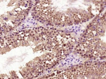 SNRNP200 Polyclonal Antibody