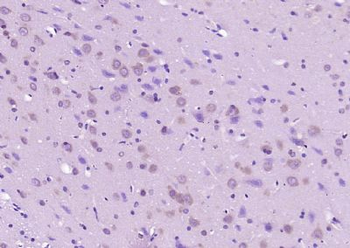 APC10 Polyclonal Antibody