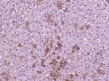 PLEKHG5 Polyclonal Antibody
