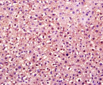 OVOL2 Polyclonal Antibody