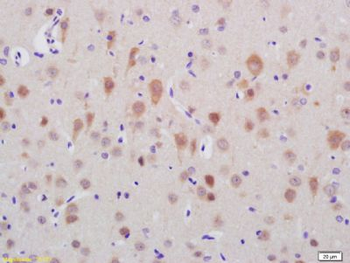 TTC21B Polyclonal Antibody