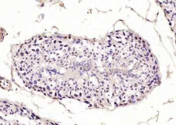 DNTNP Polyclonal Antibody
