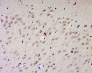 PPP1R10 Polyclonal Antibody