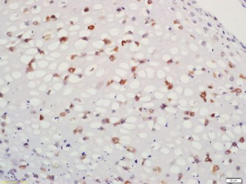 ACAN Polyclonal Antibody