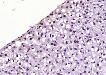 BPTF Polyclonal Antibody