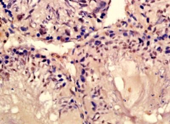 BPTF Polyclonal Antibody