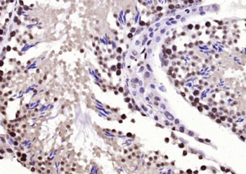 BPTF Polyclonal Antibody