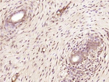 ZNF318 Polyclonal Antibody