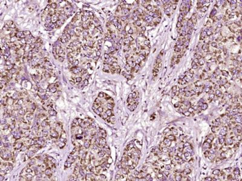 Monoamine Oxidase B Polyclonal Antibody