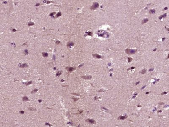ABCA7 Polyclonal Antibody