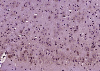 KIF5A/NKHC1 Polyclonal Antibody
