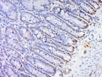 HOXc8 Polyclonal Antibody