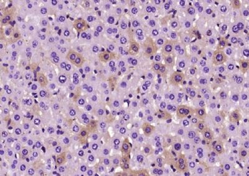 presenilin 1 Polyclonal Antibody