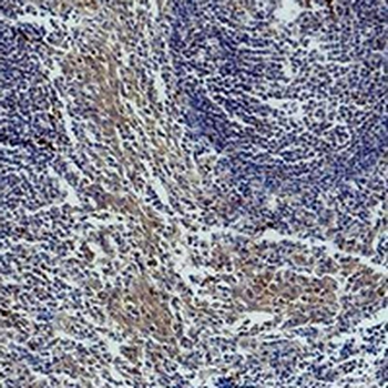 active Caspase 3 Antibody