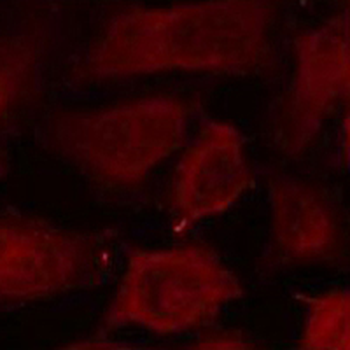 active Caspase 3 Antibody