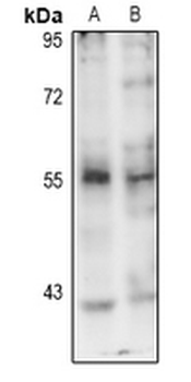 PINK1 (pS402) Antibody