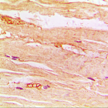 Anti-GLUT4 Antibody