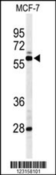NR1H3 Antibody (Center)