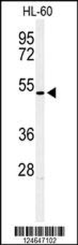 HOXA3 Antibody (C-term)
