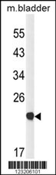 CLDN23 Antibody (C-term)
