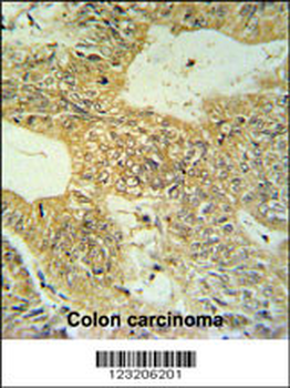 CLDN23 Antibody (C-term)