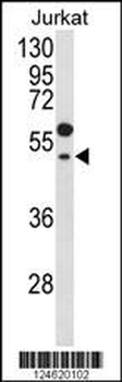 GNAT1 Antibody (C-term)