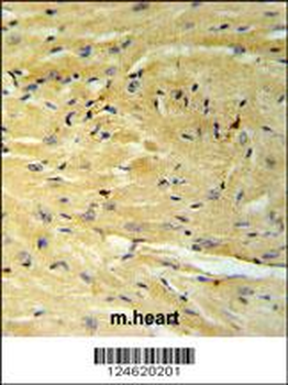 GNAT1 Antibody (C-term)
